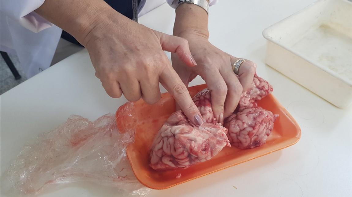 Biyoloji Laboratuvarımızda Deneyler Devam Ediyor - Beynin İncelenmesi