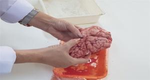 Biyoloji Laboratuvarımızda Deneyler Devam Ediyor - Beynin İncelenmesi